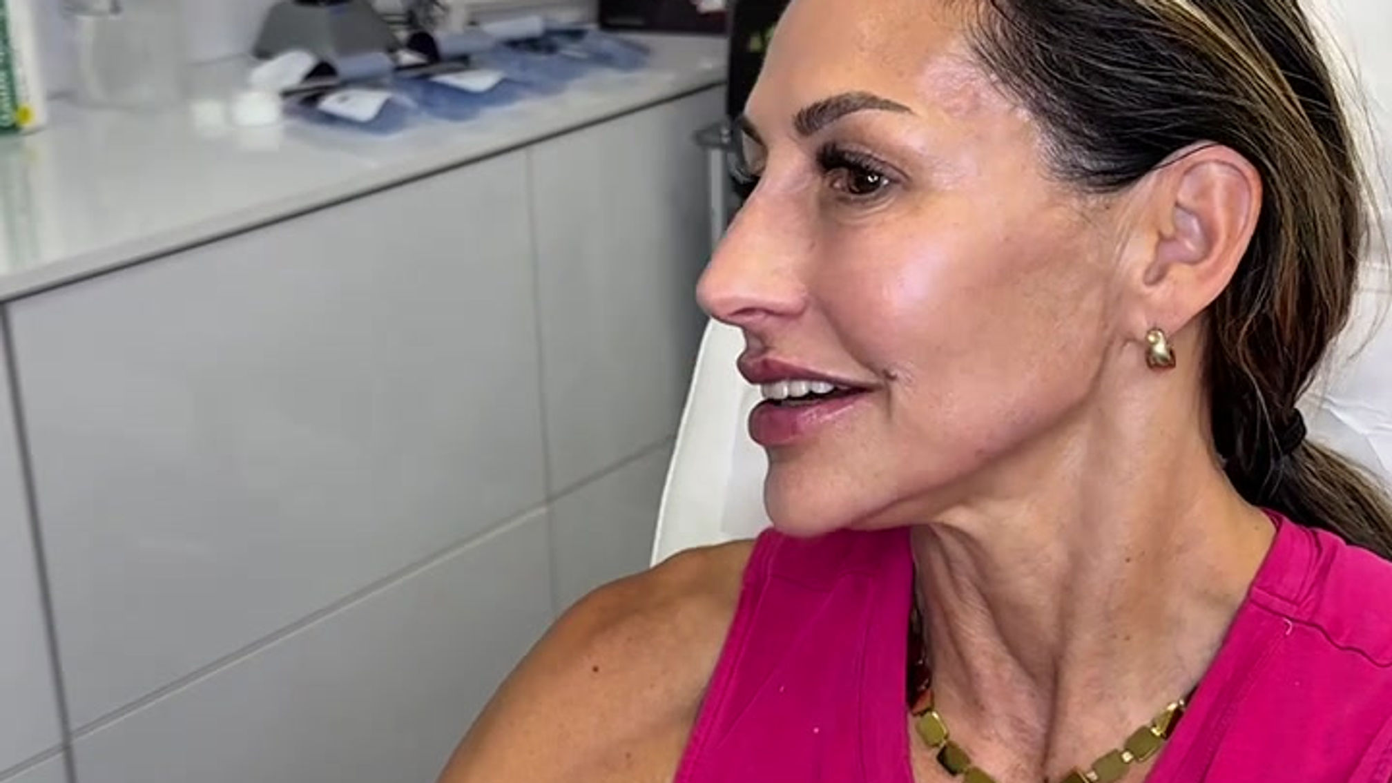 Full Face Rejuvenation